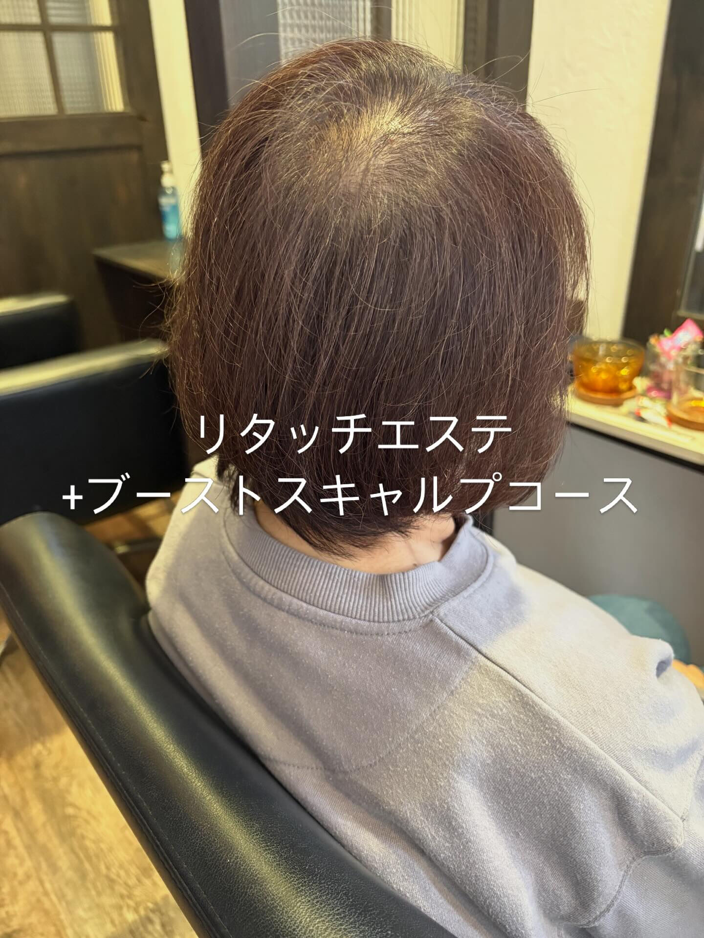 リタッチエステ+ブーストスキャルプコース