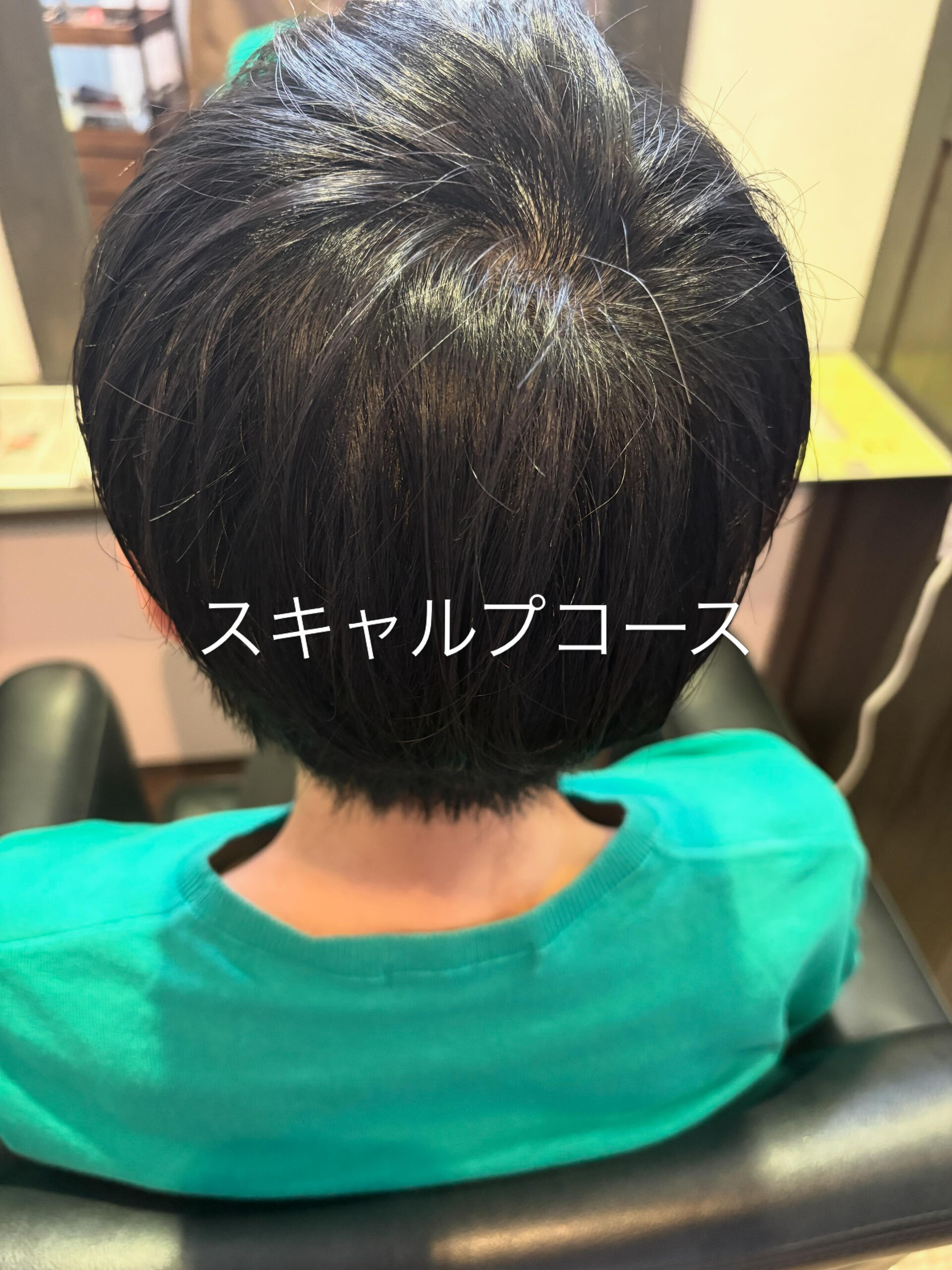 スキャルプコース