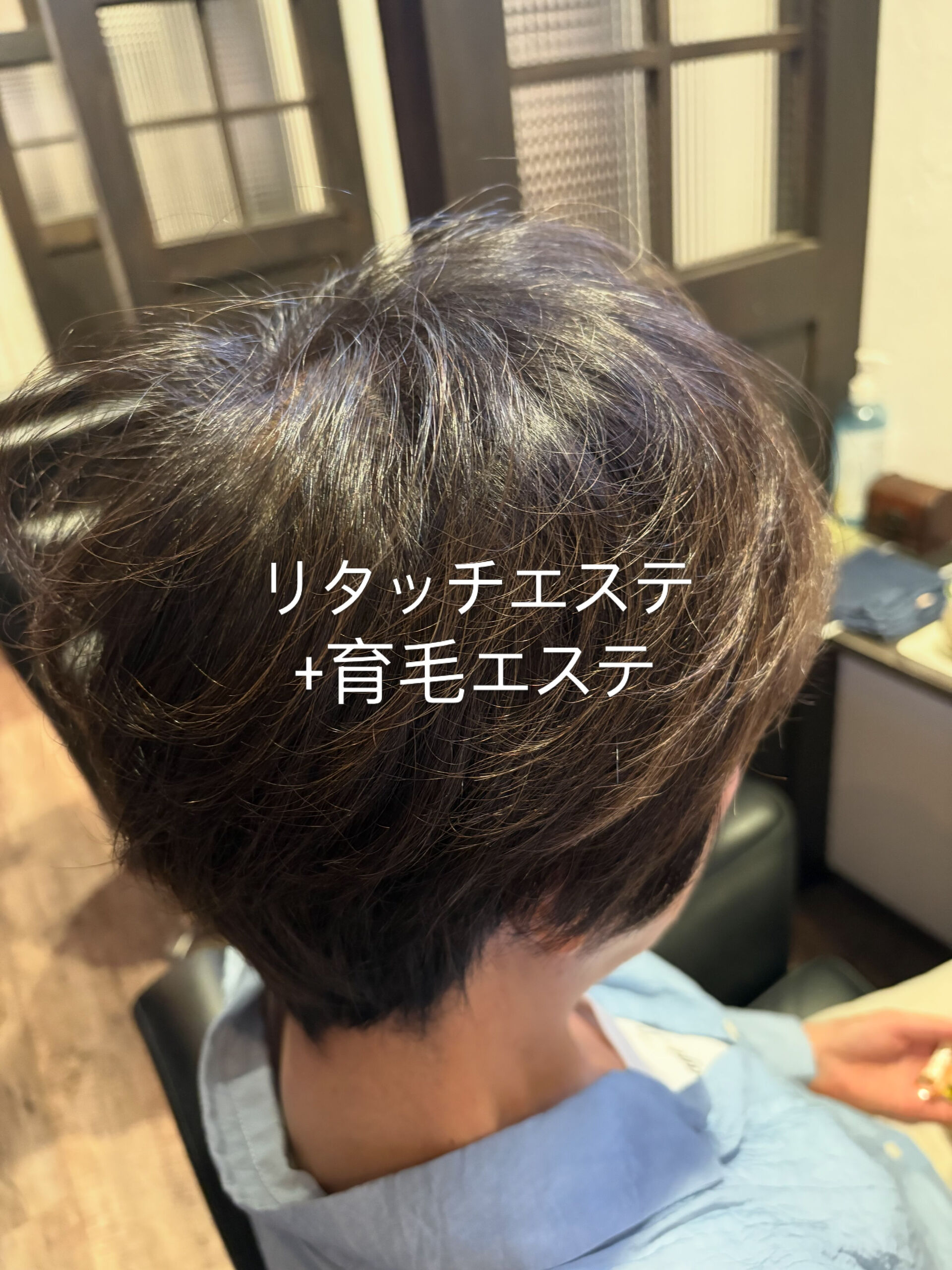 リタッチエステ+育毛エステ